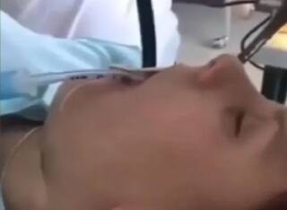 Shocking Video: ਸੁੱਤੀ ਪਈ ਔਰਤ ਦੇ ਮੂੰਹ 'ਚ ਅਚਾਨਕ ਦਾਖਲ ਹੋਇਆ ਸੱਪ, ਡਾਕਟਰ ਨੇ ਇਸ ਤਰ੍ਹਾਂ ਕੱਢਿਆ ਬਾਹਰ, ਦੇਖੋ ਵੀਡੀਓ