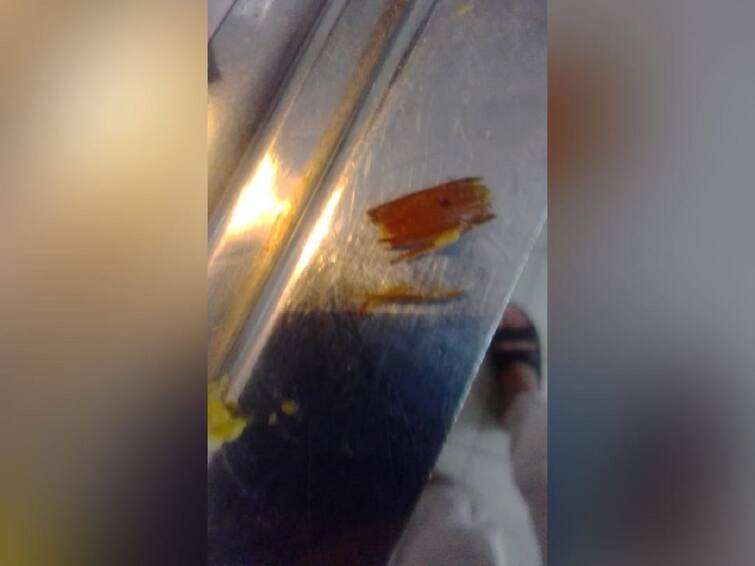 Twitter User Posts Photo Of Cockroach Found In Meal Served To AIIMS Patient, Probe Underway Twitter User Posts Photo Of Cockroach Found In Meal Served To AIIMS Patient, Probe Underway