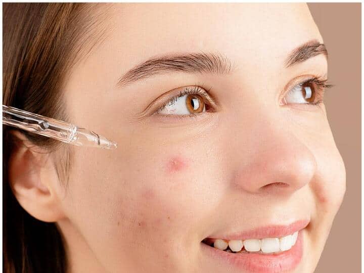 Skin Care: महंगे प्रोडक्ट से नहीं बल्कि घर में मौजूद इन चीजों से दूर करें डार्क स्पॉट, कुछ ही दिनों में चांद सा चमेगा चेहरा These home remedies will help you to remove dark spots from face Skin Care: महंगे प्रोडक्ट से नहीं बल्कि घर में मौजूद इन चीजों से दूर करें डार्क स्पॉट, कुछ ही दिनों में चांद सा चमेगा चेहरा