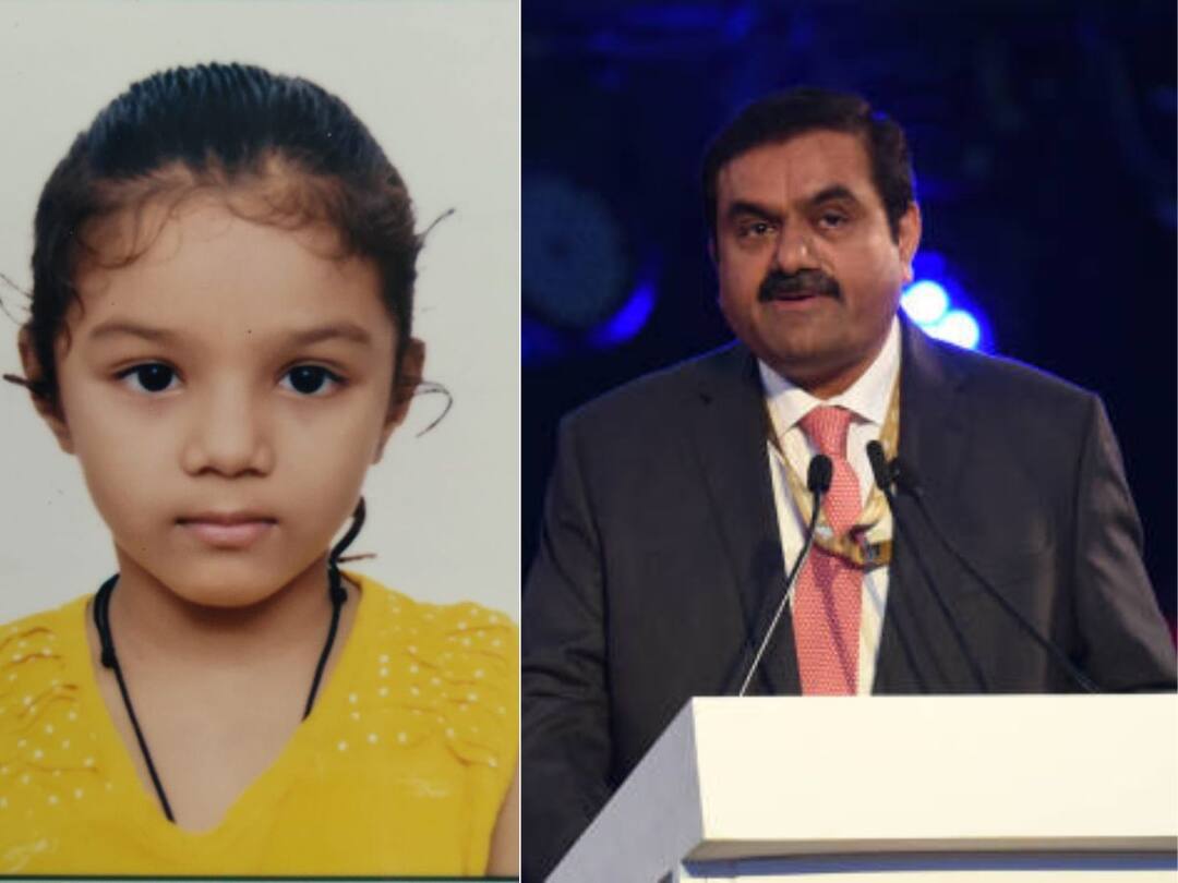 'Manushree Will Be Fine Very Soon': Gautam Adani To Fund Treatment Of 4-Yr-Old Heart Patient 'Manushree Will Be Fine Very Soon': Gautam Adani To Fund Treatment Of 4-Yr-Old Heart Patient