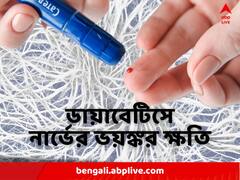 ছোট আঘাত থেকে নিঃসাড়ে গভীরে ছড়িয়ে পড়ে ক্ষত, হতে পারে অঙ্গহানিও ! স্নায়ুর উপর ডায়াবেটিসের প্রভাব ভয়ঙ্কর