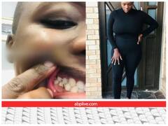 वेट घटाने को सिल लिया मुंह तो किसी ने पलक काट लीं, यहां देखें अजीबो-गरीब सर्जरी की पूरी लिस्ट