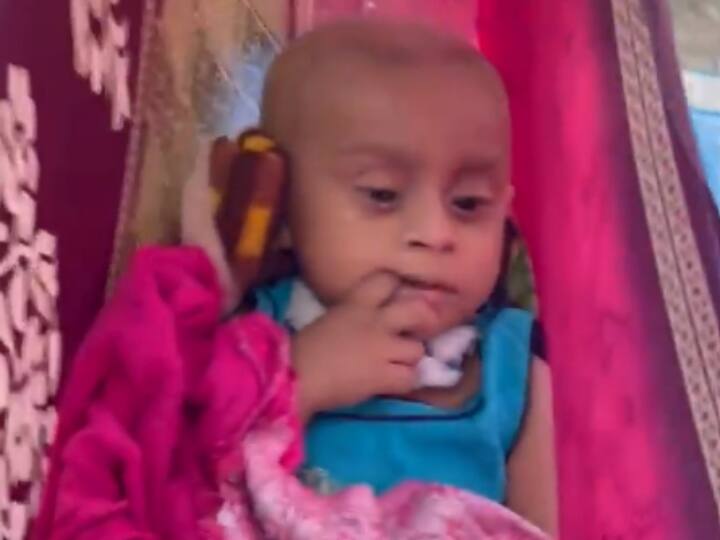 Raipur AIIMS Chhattisgarh Video of child suffering brain tumor viral CM Bhupesh Baghel asked to help ANN Raipur: बेबस मां की रुला देने वाली तस्वीर, ऑक्सीजन खरीदने के नहीं थे पैसे, फुट पंप से बच्चे को देने लगी सांस