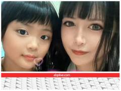 वेट घटाने को सिल लिया मुंह तो किसी ने पलक काट लीं, यहां देखें अजीबो-गरीब सर्जरी की पूरी लिस्ट