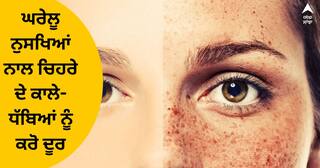 Skin Care : ਮਹਿੰਗੇ ਪ੍ਰੋਡਕਟਸ ਨਾਲ ਨਹੀਂ ਬਲਕਿ ਘਰ 'ਚ ਮੌਜੂਦ ਇਨ੍ਹਾਂ ਚੀਜ਼ਾਂ ਨਾਲ ਚਿਹਰੇ ਤੋਂ ਦੂਰ ਕਰੋ ਕਾਲੇ ਧੱਬੇ, ਚਮਕੇਗਾ ਚਿਹਰਾ