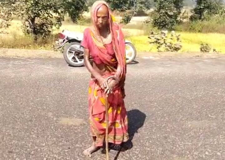 Chhattisgarh woman Suffering leprosy not getting government ration In Bharatpur ANN Chhattisgarh: 'जब ठीक हो जाए तब आना', कुष्ट रोग के चलते बुजुर्ग महिला को नहीं मिल रहा राशन