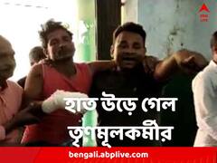 সাঁইথিয়ার পর কেশপুর, বোমাবাজিতে উড়ে গেল তৃণমূল কর্মীর হাত !