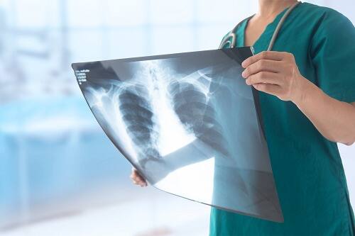 Google prepared, bringing 'AI Doctor' to India, which will tell the disease just by looking at X-Ray Google ભારતમાં લાવી રહ્યું છે 'AI ડૉક્ટર', માત્ર એક્સ-રે જોઈને જ બીમારી વિશે જણાવશી દેશે