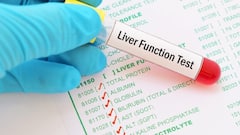 लिवर से जुड़ा है मसल्स की सेहत का राज, फिट रहना है तो ये काम जरूर करें