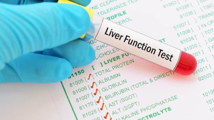 fatty liver body Muscles become very weak Fatty Liver: लिवर से जुड़ा है मसल्स की सेहत का राज, फिट रहना है तो ये काम जरूर करें