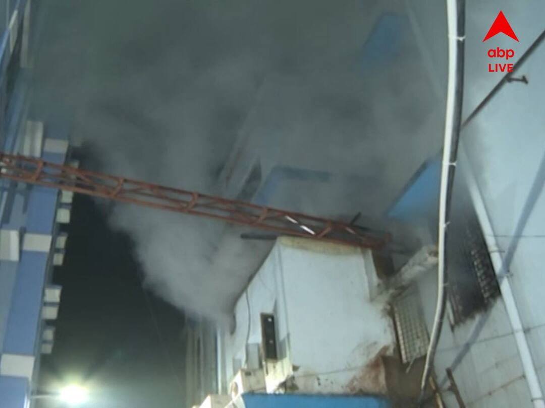 Fire in SSKM Hospital:এসএসকেএমের এমার্জেন্সি বিল্ডিংয়ের ল্যাবে আগুন SSKM Hospital Fire Live Updates Fire in CT Scan department second floor fire engines came for rescue operation know all details Fire in SSKM Hospital:এসএসকেএমের এমার্জেন্সি বিল্ডিংয়ের ল্যাবে আগুন