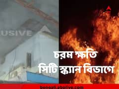 SSKM এ আগুনে চরম ক্ষতি সিটি স্ক্যান বিভাগে, বিপর্যস্ত হতে পারে আর কোন কোন পরিষেবা?