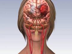 कार्डियक अरेस्ट की वजह से वेंटिलेटर पर हैं ये फेमस एक्ट्रेस, डॉक्टर ने बताया इस बीमारी की वजह से सिर में जम रहा था खून