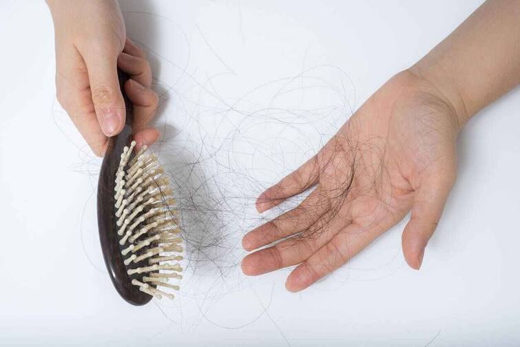 Hair Fall Solution : What is Alocepia, know why this disease causes excessive hair loss... Are you also a victim of it? Hair Fall Solution : ਕੀ ਹੈ Alocepia, ਜਾਣੋ ਕਿਉਂ ਇਸ ਬਿਮਾਰੀ ਕਾਰਨ ਬਹੁਤ ਜ਼ਿਆਦਾ ਝੜਨ ਲੱਗਦੇ ਨੇ... ਕੀ ਤੁਸੀਂ ਵੀ ਹੋ ਇਸ ਦੇ ਸ਼ਿਕਾਰ ?