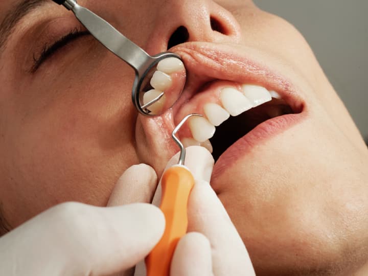 Teeth Cleaning Tips: आजकाल दात पिवळे पडणे ही एक मोठी समस्या बनली आहे.