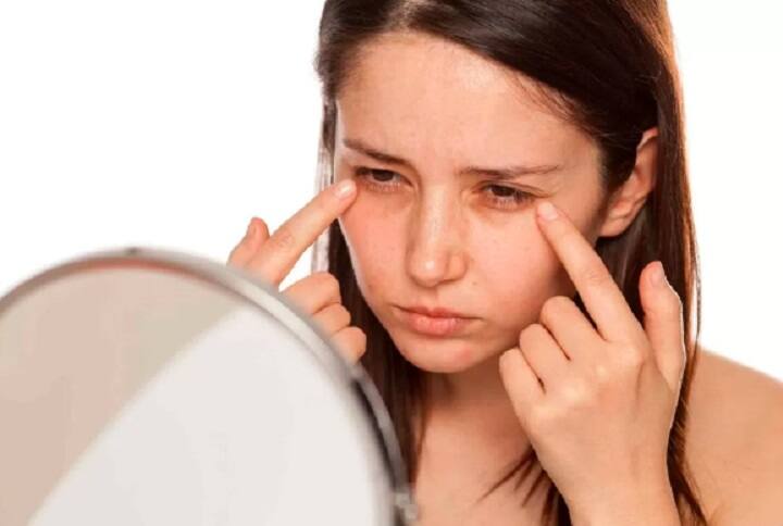 Health Tips 5 to get rid of dark circles and puffy eyes this wedding season Health Tips: கண்களுக்கு கீழே கரு வளையமா...? இதை ஃபாலோ பண்ணுங்க... சரி ஆகிடும்..!