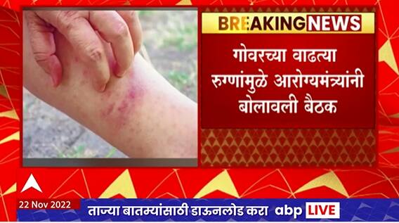 Tanaji Sawant Meeting on Measles : गोवरच्या वाढत्या रुग्णांमुळे आरोग्यमंत्र्यांनी बोलावली बैठक
