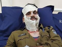 मंदसौर में मांगलिक कार्यक्रम को दौरान लगी आग, पुलिसकर्मी सहित 25 लोग झुलसे