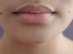 क्या होठों का कालापन आपकी भी खूबसूरती में लगा रहा है दाग? जानिए इसकी वजह और घरेलू उपचार