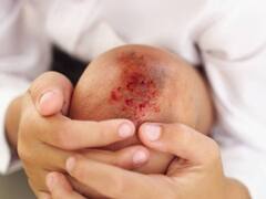 इस बीमारी की दवा की एक डोज के लिए खर्च करने होंगे 28 करोड़ रुपये