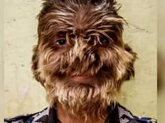 एमपी का वह लड़का, जिसके चेहरे पर उगते हैं लंबे-लंबे बाल, हनुमान मानकर पूजा करते हैं लोग