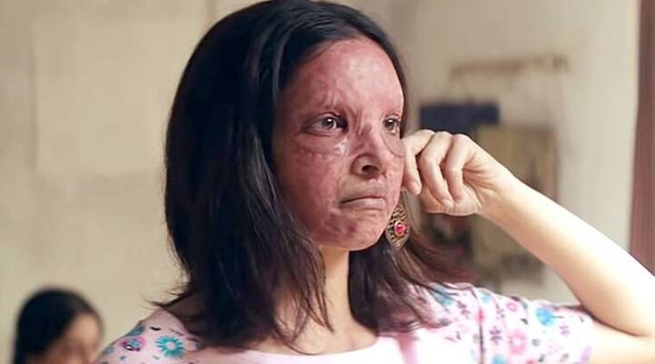 दीपिका पादुकोण – दीपिका पादुकोण ने ‘छपाक’ फिल्म में एक एसिड अटैक विक्टम का रोल निभाया था. इसमें उन्होंने अपने चेहरे पर ऐसा मेकअप किया था कि, चेहरा सच में जला हुआ लगा था.