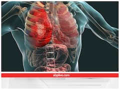 मल्टीपल ऑर्गन फेल होने से गई विक्रम गोखले की जान, ऐसे लोगों को रहता है सबसे ज्यादा खतरा