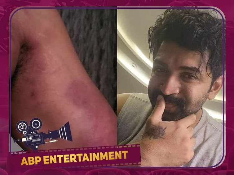 Arun Vijay injured on Vijay Acham Enbathu Illayae set Again Arun Vijay Injury: ஆக்‌ஷனை விரும்பும் அருண்விஜய்.. படப்பிடிப்பில் காயம்.. போட்டோவை வெளியிட்டு உருக்கம்!