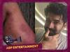 Arun Vijay Injury: ஆக்‌ஷனை விரும்பும் அருண்விஜய்.. படப்பிடிப்பில் காயம்.. போட்டோவை வெளியிட்டு உருக்கம்!
