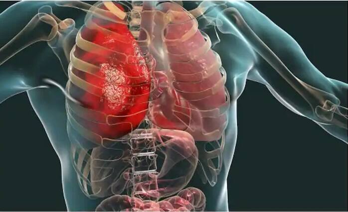 what is multiple organ disfunction syndrome મલ્ટી ઓર્ગન ફેલ્યોરના કારણે વિક્રમ ગોખલેનું થયું નિધન, જો આ સંકેત દેખાય તો થઇ જાવ સાવધાન