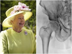 క్వీన్ ఎలిజబెత్ డెత్ మిస్టరీ - చివరి రోజుల్లో ఆమెకు నరకం చూపిన ఆ వ్యాధి ఇదే, ఈ లక్షణాలుంటే జాగ్రత్త