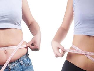 Weight Loss Surgery: વજન ઘટાડવાની સર્જરી કોણ કરાવી શકે છે?