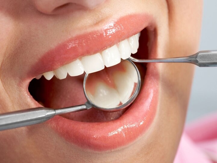 Indian Dental Association: இந்திய பல் மருத்துவ சங்கத் தேர்தலில் போலி வாக்காளர்களா..? விளக்கம் கேட்ட நீதிமன்றம்..!