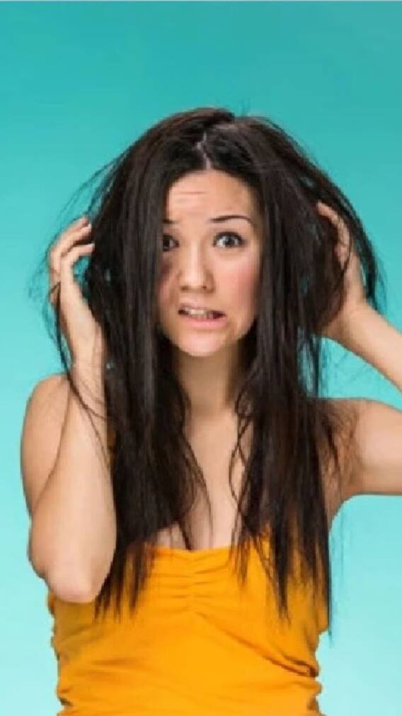 খুসকি দূর করার সহজ উপায়