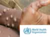 Monkeypox virus: குரங்கு அம்மைக்கு புது பெயர் - உலக சுகாதார அமைப்பு அறிவிப்பு
