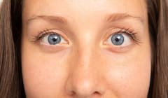 Squint Or Starbisums : ਬੱਚਿਆਂ 'ਚ ਭੈਂਗੇਪਣ ਦੇ ਇਹ ਹਨ ਮੁੱਖ ਕਾਰਨ, ਜਾਣੋ