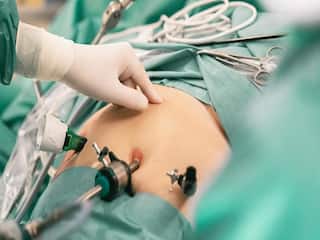 વજન ઘટાડવાની સર્જરીને કારણે મહિલાનું મોત! જાણો બેરિયાટ્રિક ઓપરેશન શું છે અને તે કેટલું સુરક્ષિત છે?