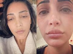 Shruti Haasan Pics: बिखरे बाल और सूजे होंठ में बीमार लगीं श्रुति हासन, एक्ट्रेस का अनफिल्टर्ड फेस देख फैंस हुए इम्प्रेस