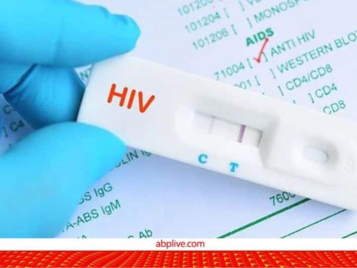 HIV संक्रमण को पता करने के लिए कौन-कौन से टेस्ट हैं? क्या है सही समय, यहां जानिए AIDS day know about different type of test that are available to detect HIV how much they cost HIV संक्रमण को पता करने के लिए कौन-कौन से टेस्ट हैं? क्या है सही समय, यहां जानिए