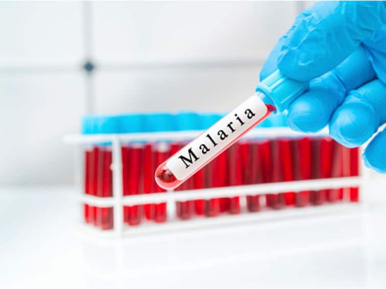 Scientists Develop Two mRNA Vaccine Candidates 'Highly Effective' In Reducing Malaria Infection, Transmission: Study Scientists Develop Two mRNA Vaccine Candidates 'Highly Effective' In Reducing Malaria Infection, Transmission: Study