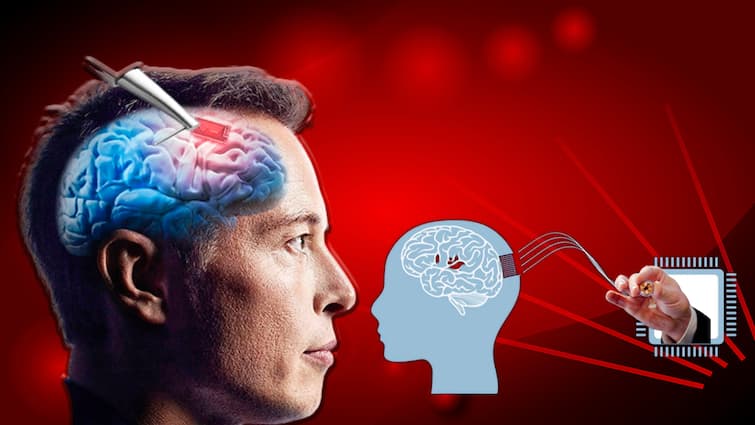 Neuralink Brain Chip: Elon Musk's company Neuralink can start brain chip trial soon, know what will be its benefits Neuralink Brain Chip: ઇલોન મસ્કની કંપની ન્યુરાલિંક ટૂંક સમયમાં શરૂ કરી શકે છે બ્રેઈન ચિપ ટ્રાયલ, જાણો શું થશે તેના ફાયદા