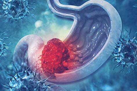 ਕੀ ਤੁਸੀਂ ਲਗਾਤਾਰ ਕਮਜ਼ੋਰੀ ਮਹਿਸੂਸ ਕਰ ਰਹੇ ਹੋ, ਜਾਂ ਕੀ ਤੁਸੀਂ ਲਗਾਤਾਰ ਐਸੀਡਿਟੀ ਅਤੇ ਉਲਟੀਆਂ ਦੀ ਸਮੱਸਿਆ ਦਾ ਸਾਹਮਣਾ ਕਰ ਰਹੇ ਹੋ।