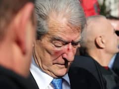 अल्बानिया में विपक्ष के नेता सरकार के खिलाफ कर रहे थे विरोध प्रदर्शन, मुंह पर पड़ गया मुक्का