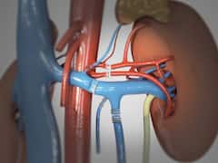 एक किडनी के सहारे काटी जा सकती है जिंदगी लेकिन अपनी डाइट से इन चीजों को कर दें गुडबाय