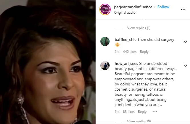 Jacqueline Fernandez Video: जैकलीन फर्नांडिस ने सर्जरी को बताया गलत, भड़के यूजर्स, जमकर सुनाई खरी-खोटी