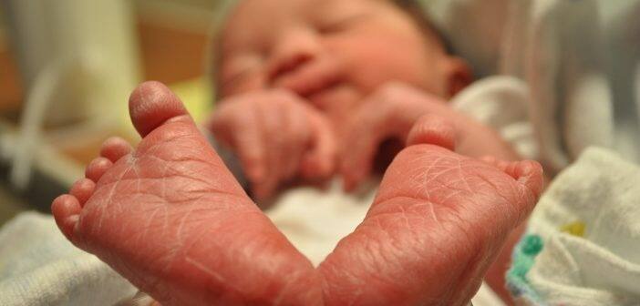 ਉਦਾਹਰਨ ਲਈ, ਛੋਟੀਆਂ ਅੱਖਾਂ, ਉੱਪਰੀ ਨੱਕ, ਪਤਲੇ ਉਪਰਲੇ ਬੁੱਲ੍ਹ, ਨੱਕ ਅਤੇ ਉੱਪਰਲੇ ਬੁੱਲ੍ਹਾਂ ਵਿਚਕਾਰ ਪਤਲੀ ਚਮੜੀ ਸ਼ਾਮਲ ਹਨ।