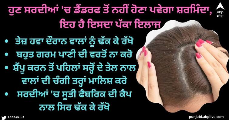 Winter Hair Care: Dandruff is embarrassing in winter, so know the sure cure, keep these things in mind while shampooing. Winter Hair Care : ਸਰਦੀਆਂ 'ਚ ਡੈਂਡਰਫ ਕਾਰਨ ਹੋਣਾ ਪੈ ਰਿਹੈ ਸ਼ਰਮਿੰਦਾ ਤਾਂ ਜਾਣ ਲਓ ਇਸਦਾ ਪੱਕਾ ਇਲਾਜ, ਸ਼ੈਂਪੂ ਕਰਦੇ ਸਮੇਂ ਧਿਆਨ ਰੱਖੋ ਇਹ ਗੱਲਾਂ