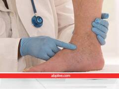 खराब ब्लड सर्कुलेशन की वजह से शरीर में दिखते हैं ये 4 लक्षण, जानें इसका कारण