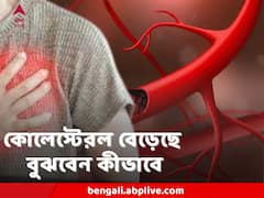 Cholesterol : এই লক্ষণগুলিই বলে দেবে আপনার খারাপ কোলেস্টেরলের মাত্রা বেড়েছে কি না