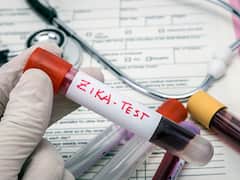 Karnataka: Five-Year-Old Girl Becomes First Confirmed Zika Virus Case In State